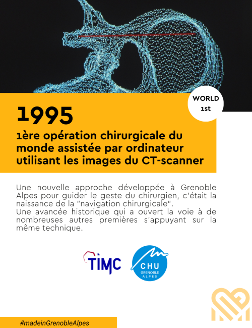 1995 : 1ère opération chirurgicale du monde assistée par ordinateur utilisant les images du CT-scanner